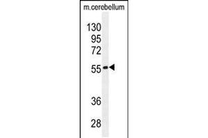 Western blot analysis in mouse cerebellum tissue lysates (35ug/lane). (FAM69B 抗体  (N-Term))