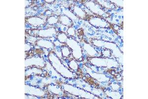 Immunohistochemistry (IHC) image for anti-Glutathione S-Transferase theta 1 (GSTT1) (AA 1-240) antibody (ABIN3021871)