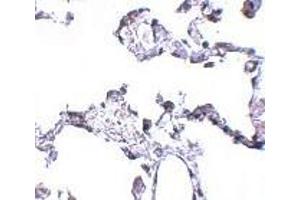 Immunohistochemistry of CD81 in human lung tissue with CD81 antibody at 5 μg/ml. (CD81 抗体  (N-Term))