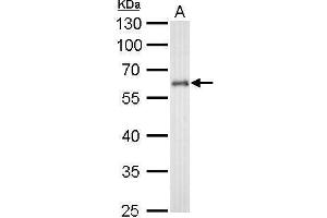 Western Blotting (WB) image for anti-Cytochrome P450, Family 1, Subfamily B, Polypeptide 1 (CYP1B1) (Center) antibody (ABIN2855824)
