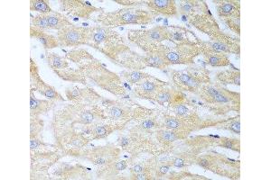 Immunohistochemistry (Paraffin-embedded Sections) (IHC (p)) image for anti-Nudix (Nucleoside Diphosphate Linked Moiety X)-Type Motif 15 (NUDT15) antibody (ABIN7264397)