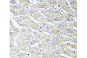 Immunohistochemistry of paraffin-embedded Human liver using NUDT15 Polyclonal Antibody at dilution of 1:100 (40x lens).