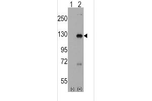 Western blot analysis of DAAM1 using rabbit polyclonal DAAM1 Antibody(Human C-term) using 293 cell lysates (2 ug/lane) either nontransfected (Lane 1) or transiently transfected with the DAAM1 gene (Lane 2). (DAAM1 抗体  (C-Term))