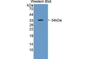 Detection of Recombinant ENDOG, Human using Polyclonal Antibody to Endonuclease G, Mitochondrial (ENDOG)