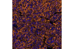 Immunofluorescence (IF) image for anti-Poliovirus Receptor (PVR) (AA 28-329) antibody (ABIN7449549)