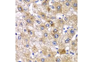 Immunohistochemistry of paraffin-embedded human liver injury using AMY2A antibody (ABIN5975245) at dilution of 1/100 (40x lens). (AMY2A 抗体)