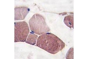 IHC analysis of FFPE human skeletal muscle tissue stained with UCHL3 antibody (UCHL3 抗体  (AA 195-225))