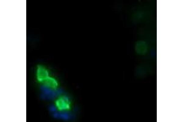 MDM4-binding Protein 抗体