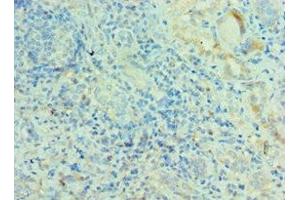 Immunohistochemistry of paraffin-embedded human kidney tissue using ABIN7142389 at dilution of 1:100 (MRPL28 抗体  (AA 1-256))