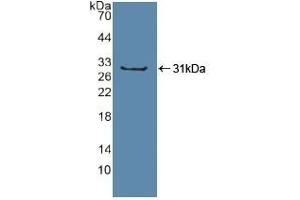 Detection of Recombinant Sp100, Human using Polyclonal Antibody to Sp100 Nuclear Antigen (Sp100) (SP100 抗体  (AA 610-802))