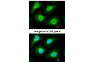 ICC/IF Image Immunofluorescence analysis of paraformaldehyde-fixed HeLa, using 20S Proteasome alpha1, antibody at 1:200 dilution. (Proteasome 20S alpha 1 (Center) 抗体)