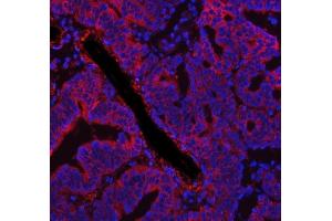 IF analysis of FASN using anti-FASN antibody (ABIN3044520). (Fatty Acid Synthase 抗体  (AA 1-226))