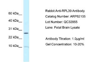 Western Blotting (WB) image for anti-Ribosomal Protein L39 (RPL39) (N-Term) antibody (ABIN2789019) (RPL39 抗体  (N-Term))