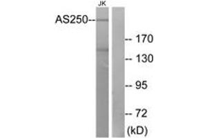 Western blot analysis of extracts from Jurkat cells, using AS250 Antibody. (RALGAPA2 抗体  (AA 641-690))