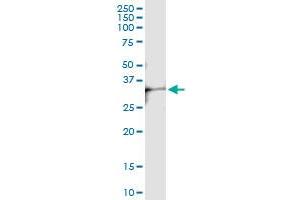 Immunoprecipitation (IP) image for anti-Corticotropin Releasing Hormone Binding Protein (CRHBP) (AA 1-322) antibody (ABIN514596)