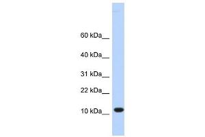 C10ORF57 antibody used at 1 ug/ml to detect target protein. (CJ057 抗体  (Middle Region))
