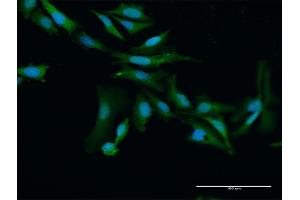 Immunofluorescence of purified MaxPab antibody to PRAME on HeLa cell.