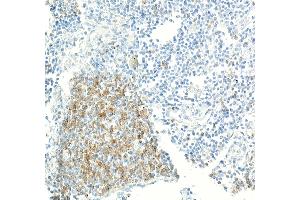 Immunohistochemistry (IHC) image for anti-CD70 Molecule (CD70) (AA 50-193) antibody (ABIN7795663)