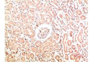 Immunohistochemical analysis of paraffin-embedded Human Kidney Tissue using Collagen IV Mouse mAb diluted at 1:200. (COL4A1 抗体)