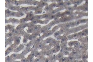 DAB staining on IHC-P; Samples: Rabbit Liver Tissue (C9 抗体  (AA 139-519))