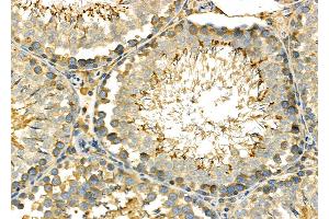 ABIN6264529 and ABIN6278030 at 1/100 staining Rat testis tissue by IHC-P. (PUM1 抗体  (Internal Region))
