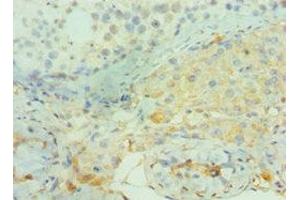 Immunohistochemistry of paraffin-embedded human testis tissue using ABIN7160382 at dilution of 1:100 (BIN1 抗体  (AA 414-593))