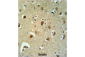 Immunohistochemistry (IHC) image for anti-UDP-Gal:betaGal beta 1,3-Galactosyltransferase Polypeptide 6 (B3GALT6) antibody (ABIN3002204) (B3GALT6 抗体)