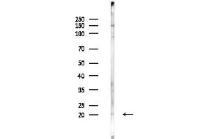 anti-Adaptor-Related Protein Complex 2, sigma 1 Subunit (AP2S1) (N-Term) antibody