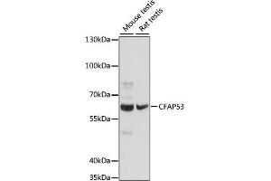 Western blot analysis of extracts of various cell lines, using CF antibody (ABIN7266431) at 1:1000 dilution. (CCDC11 抗体  (AA 1-300))