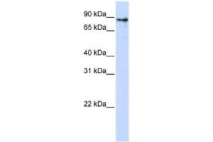KLHL1 antibody used at 0. (KLHL1 抗体  (Middle Region))
