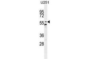 CCDC9 Antibody (N-term) western blot analysis in U251 cell line lysates (35µg/lane). (CCDC9 抗体  (N-Term))