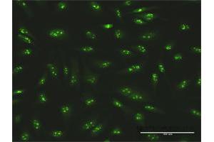 Immunofluorescence (IF) image for anti-SWI/SNF Related, Matrix Associated, Actin Dependent Regulator of Chromatin, Subfamily A, Member 5 (SMARCA5) (AA 1-1052) antibody (ABIN521925)
