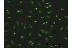 Immunofluorescence of purified MaxPab antibody to SMARCA5 on HeLa cell. (SMARCA5 抗体  (AA 1-1052))