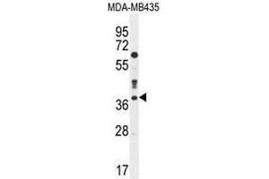 CASP3 Antibody (C-term) western blot analysis in MDA-MB435 cell line lysates (35µg/lane). (Caspase 3 抗体  (C-Term))