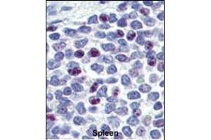 Immunohistochemistry (Paraffin-embedded Sections) (IHC (p)) image for anti-Kruppel-Like Factor 4 (Gut) (KLF4) (AA 69-101) antibody (ABIN389187)