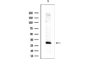 Western blot analysis of lysates from EC304 cells(heat-shock treatment), using IGFBP7 Antibody at 1/1000 dilution.