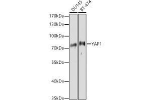Western blot analysis of extracts of various cell lines, using Y antibody (ABIN6132787, ABIN6150315, ABIN6150320 and ABIN6214108) at 1:1000 dilution.