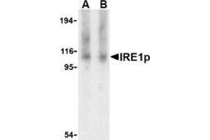 Western blot analysis of IRE1p in Raji cell lysate with AP30446PU-N IRE1p antibody at (A) 1 and (B) 2 μg/ml. (ERN1 抗体  (Intermediate Domain))