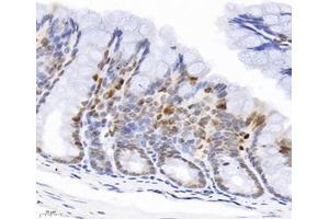 Immunohistochemistry analysis of paraffin-embedded mouse colon using,GINS2 (ABIN7074041) at dilution of 1: 3000 (GINS2 抗体)