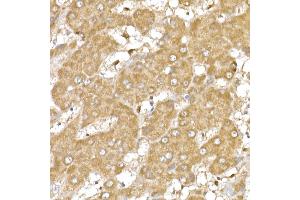 Immunohistochemistry (IHC) image for anti-Actin, alpha 2, Smooth Muscle, Aorta (ACTA2) (AA 1-124) antibody (ABIN6136473)