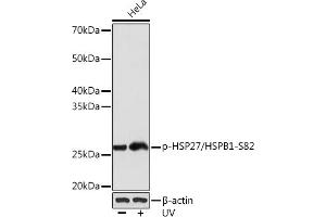 Western blot analysis of extracts of HeLa cells, using Phospho-HSP27/HSPB1-S82 Rabbit mAb (ABIN7267571) at 1:1000 dilution. (HSP27 抗体  (pSer82))