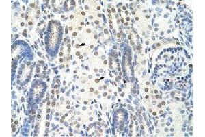 Image no. 1 for anti-Splicing Factor 1 (SF1) (N-Term) antibody (ABIN203234) (Splicing Factor 1 抗体  (N-Term))