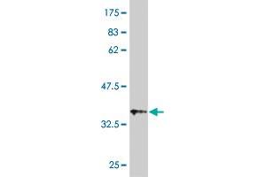 Western Blot detection against Immunogen (36. (UGT1A3 抗体  (AA 30-129))