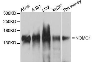 Western blot analysis of extracts of various cells, using NOMO1 antibody. (NOMO1 抗体)