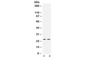 Western blot testing of rat 1) pancreas and 2) NRK lysate with FGF19 antibody at 0. (FGF19 抗体)