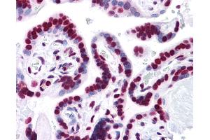 Anti-HMGB1 antibody IHC of human placenta. (HMGB1 抗体  (AA 1-216))
