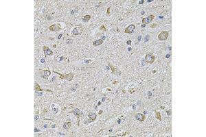 Immunohistochemistry of paraffin-embedded rat brain using FASTKD1 Antibody (ABIN5975129) at dilution of 1/100 (40x lens). (FASTKD1 抗体)