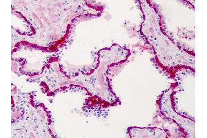Anti-SLFN12 antibody IHC of human prostate. (SLFN12 抗体  (C-Term))