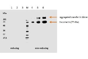 Human transferrin detected by the mouse monoclonal antibody HTF-14. (Transferrin 抗体)