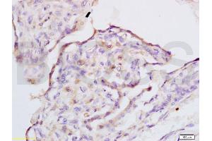Formalin-fixed and rabbit placenta tissue labeled with Anti-IQGAP1 Polyclonal Antibody, Unconjugated (ABIN737796) at 1:200 followed by conjugation to the secondary antibody and DAB staining (IQGAP1 抗体  (AA 1451-1550))